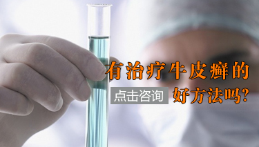 湖北主治牛皮癣的医院