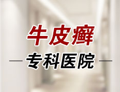 湖南市治疗银屑病医院