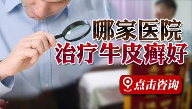 辽宁治银屑病好医院